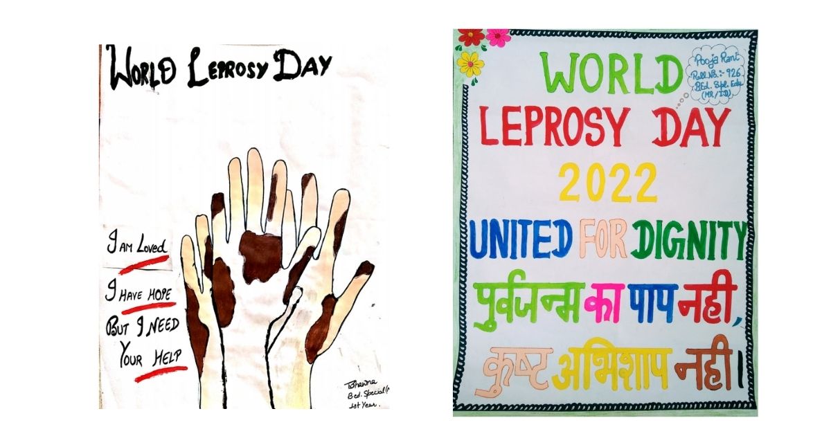 leprosy day